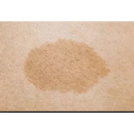 Anti brown spots on skin  30 x 500mg